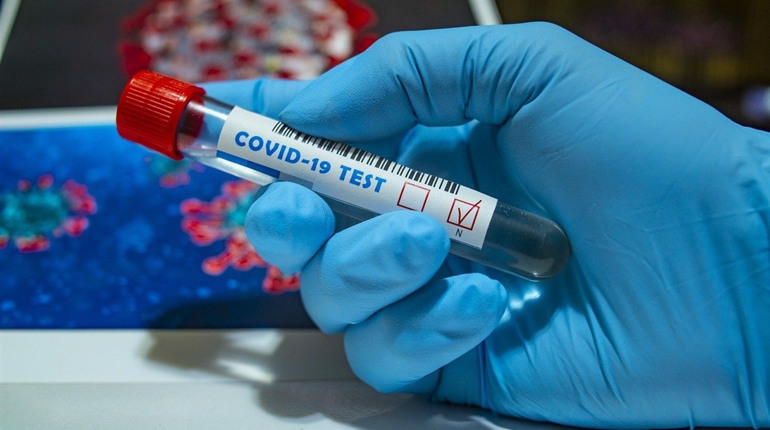За останню добу в Южному ще 5 осіб захворіло на Covid-19