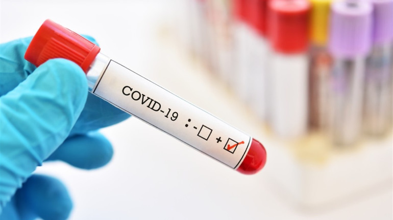 Статистика COVID-19 на Гадяччині