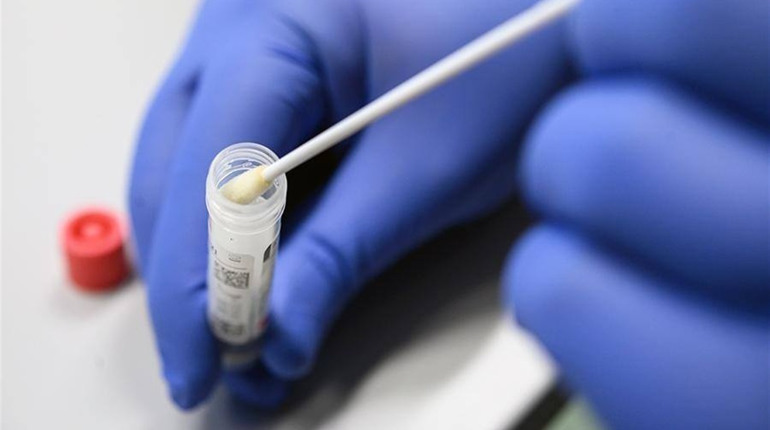 З початку пандемії на Луганщині від коронавірусу померло 400 людей