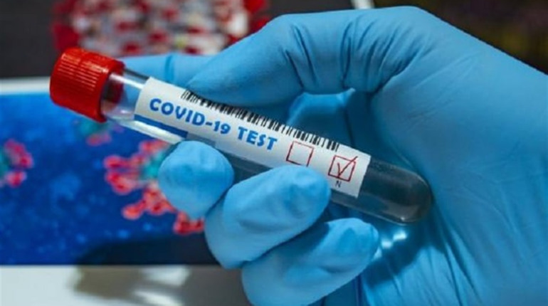 З початку пандемії на Луганщині від COVID-19 померли 412 людей