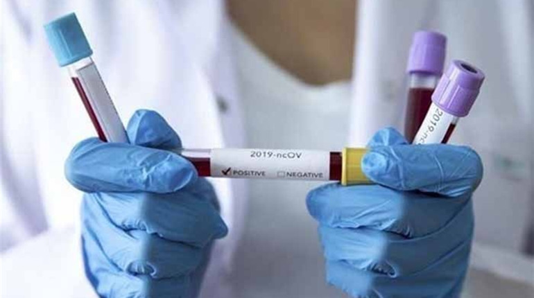 На Чортківщині другу добу поспіль виявляють понад 23 нових випадків COVID-19