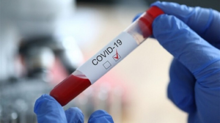 COVID-19 на Чортківщині: лабораторно підтверджено 34 нових випадки