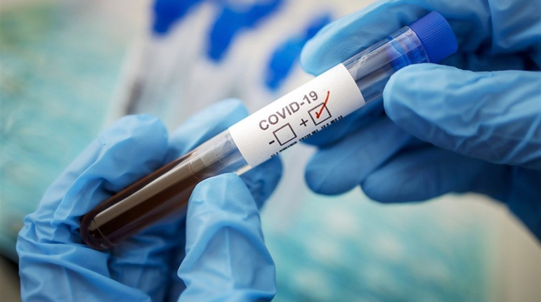 На Чортківщині - 135 нових випадків COVID-19