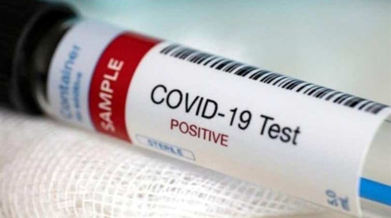 COVID-19 на Гадяччині: ситуація станом на 17 березня