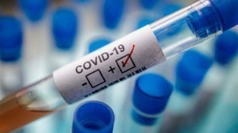 COVID-19 на Чортківщині: 154 нових випадки. Одна людина померла