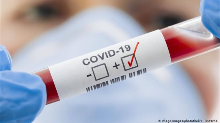 COVID-19 на Чортківщині: 163 нових випадків, два - летальних