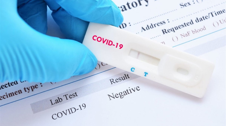COVID-19 за добу підтвердили у 77 чортків'ян, один летальний випадок