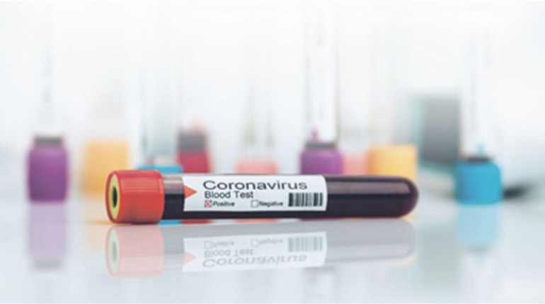 COVID-19 на Гадяччині: ситуація станом на 19 квітня