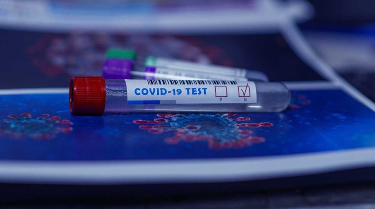 COVID-19 на Гадяччині: зареєстровано 48 нових випадків