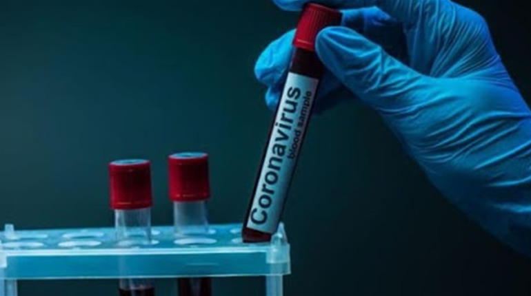 За добу в Луганській області виявили 157 хворих на COVID-19