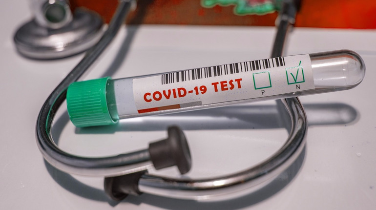 За минулу добу на COVID-19 захворіли всього 9 містян