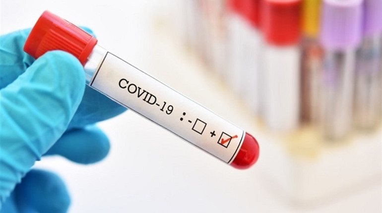 За добовою смертністю від COVID-19 Україна залишається другою в Європі