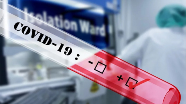 За добу в Луганській області виявили 123 хворих на COVID-19