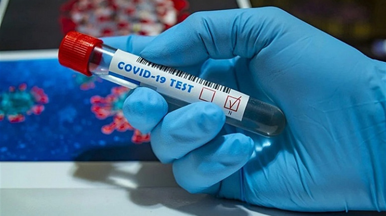 Від початку пандемії на COVID-19 в Україні захворіло понад 2 млн людей, померло - 50 тисяч