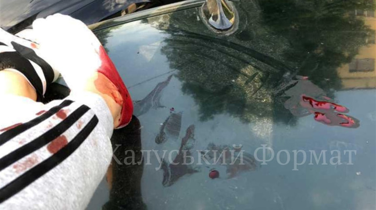 У Калуші собака напав на молодь