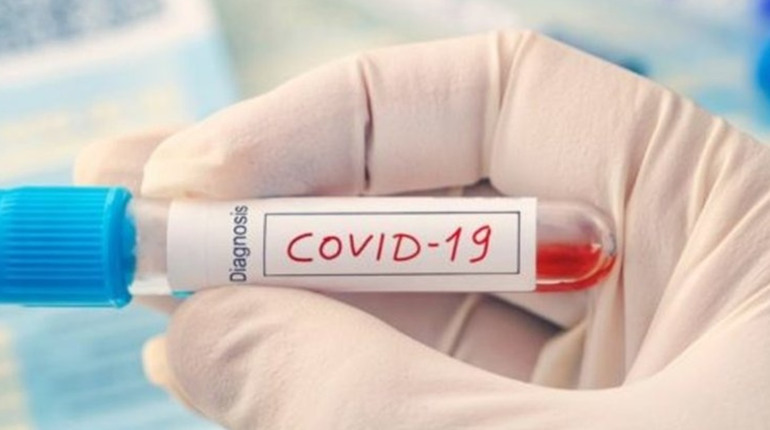 COVID-19 на Чортківщині: 9 нових випадків за добу, одна особа померла