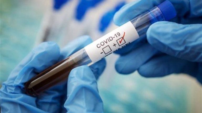На Чортківщині - 1 новий випадок COVID-19