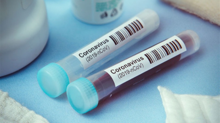На Чортківщині виявили 2 нових випадки COVID-19