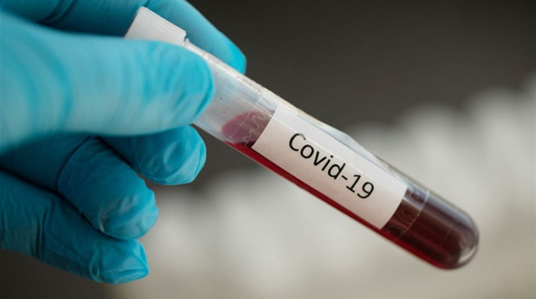 На Чортківщині за добу виявили 1 новий випадок COVID-19