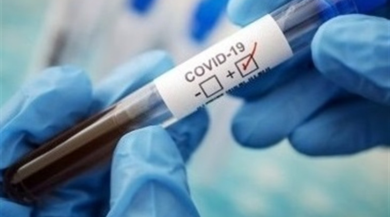 За попередню добу на Чортківщині зафіксовано 1 новий випадок COVID-19