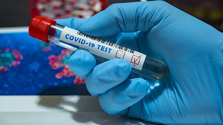 Covid-19: за тиждень діагностовано 31 новий випадок, серед хворих є дитина