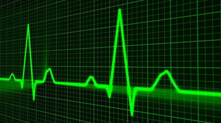 У Первомайську можна буде отримати консультацію фахівців Інституту серця: де, коли та як