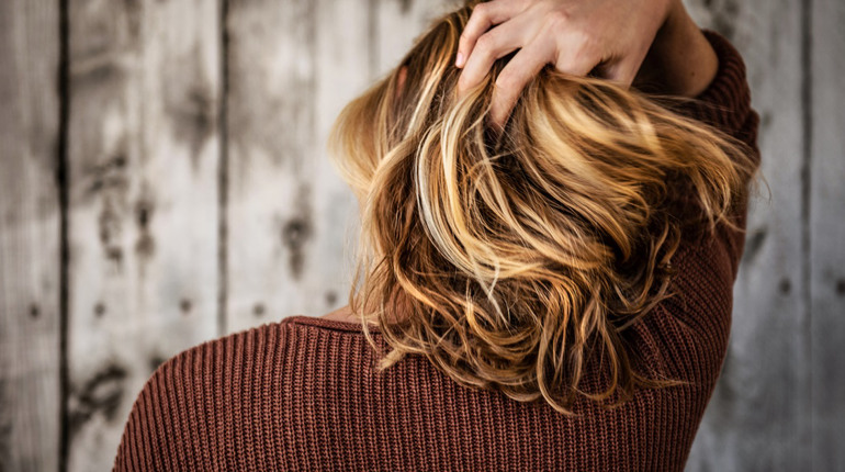 Випадіння волосся: причини, міфи, лікування