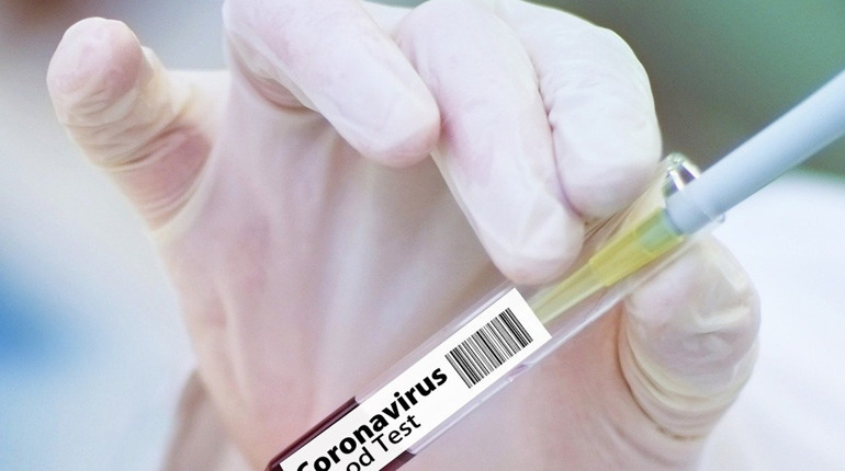 Ковідна статистика: за новорічні вихідні у Первомайській ЦРЛ померли 4 людини