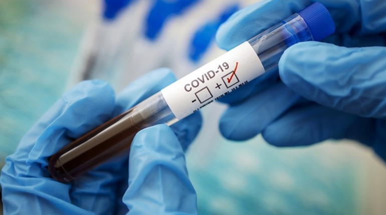 Кількість хворих стрімко зростає: розподіл випадків COVID-19 в Чернівецькій області за громадами