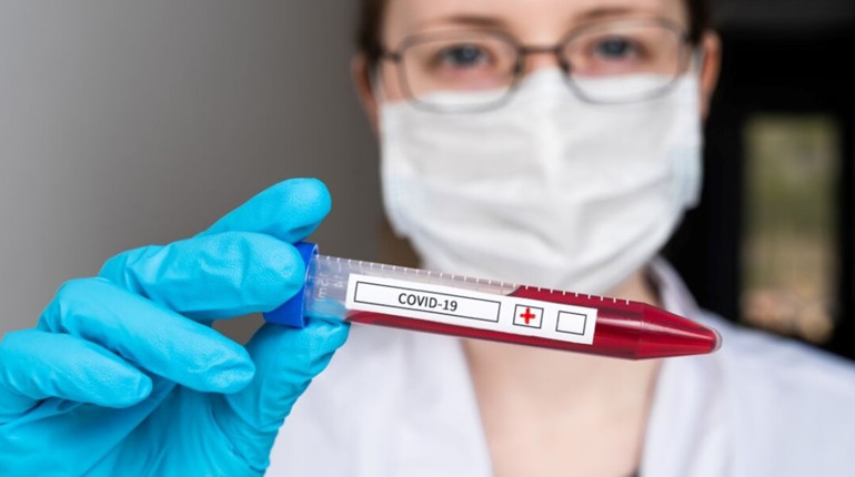 У МОЗ розповіли, коли захворюваність на COVID-19 почне знижуватися