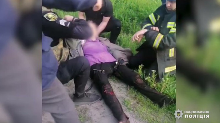 Жінці з Торецька перебило осколками обидві ноги – поранену рятували парамедики