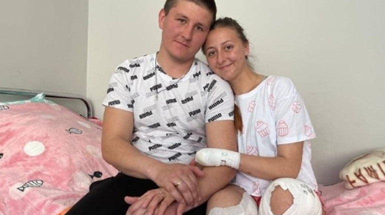 Лисичанка, яка втратила обидві ноги, проходить реабілітацію в Німеччині. Історія одужання