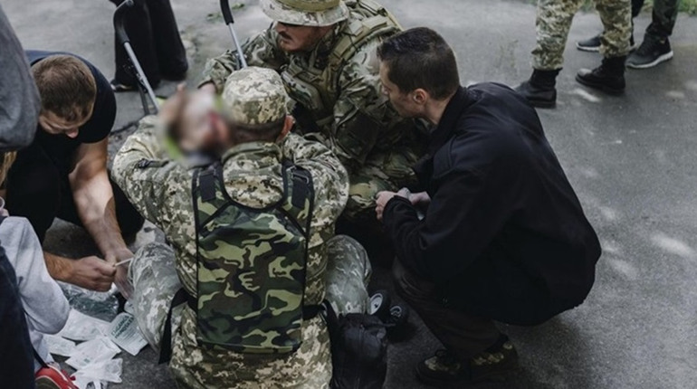 Перев'язували обличчя та перевіряли чи цілі органи: як волонтер та військовий рятували Рому на Валу