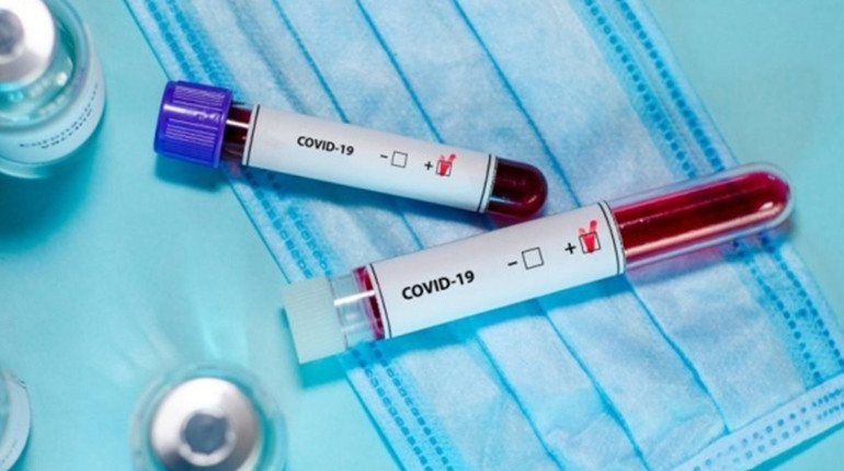 За тиждень на Covid-19 захворіло 44 людини