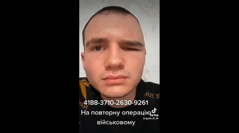 Військовому з Волновахи провели неякісну операцію — імплант видавлює око. Мати благає про допомогу