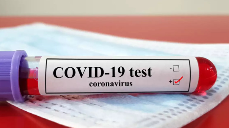 Минулого тижня від COVID-19 на Полтавщині ніхто не помер