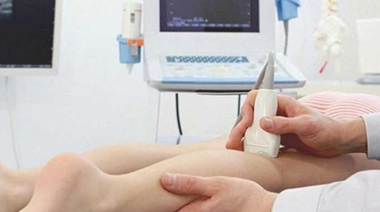 Як лікувати варикозне розширення вен