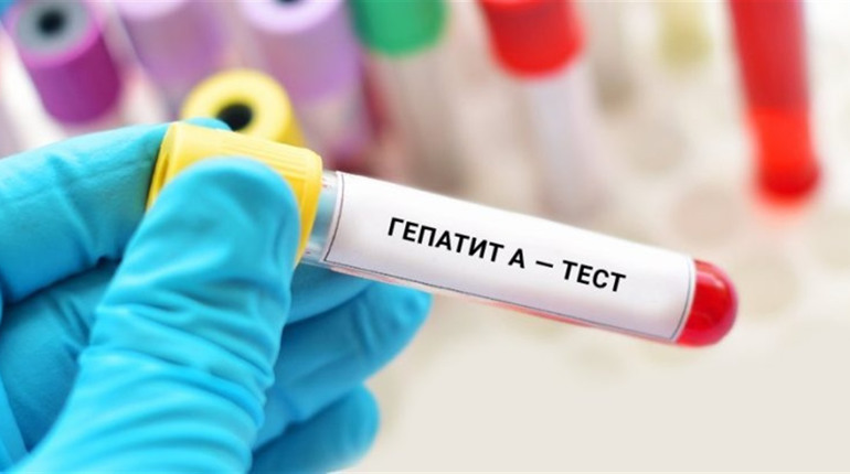 В Україні спалах гепатиту А: як передається і як вберегтися від зараження? Ситуація на Переяславщині