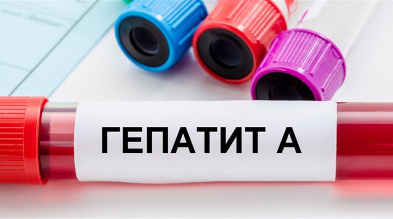 На Київщині підтвердили 5 випадків захворювання на гепатит А: що відомо
