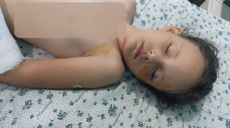 Перевернувся батут, 7-річна дівчинка травмована, матір просить про підтримку
