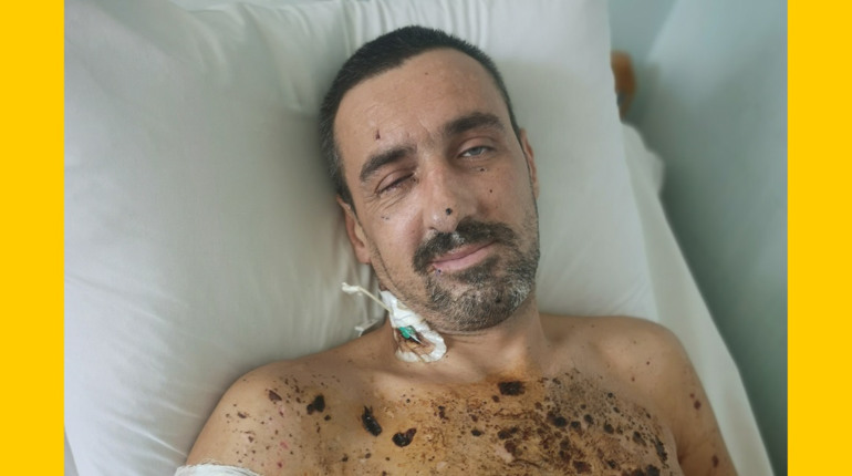 Важко поранений військовий із Первомайська: родина просить підтримки