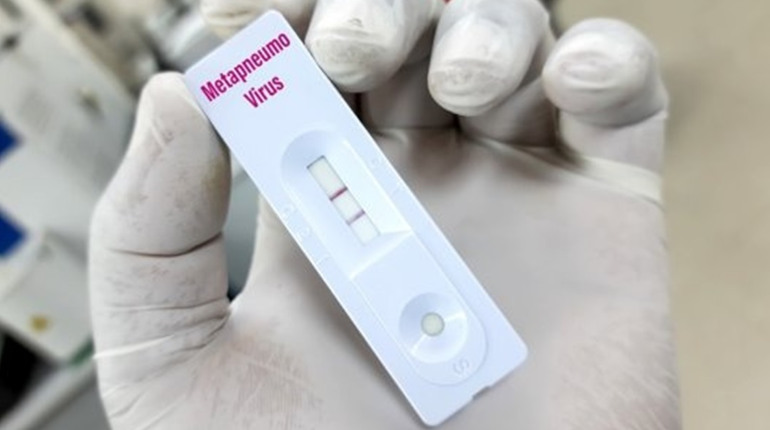 На Одещині зафіксовано сім випадків метапневмовірусу: що треба знати