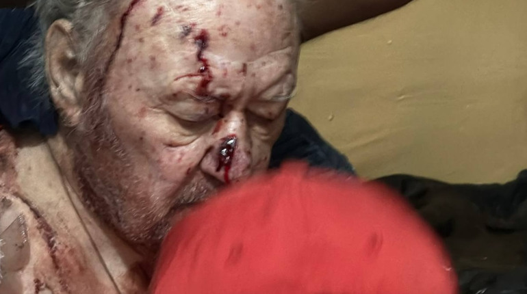 Атака на Одесу: удар дронів по пологовому, «швидкій» та житлових будинках. Є загиблі і поранені