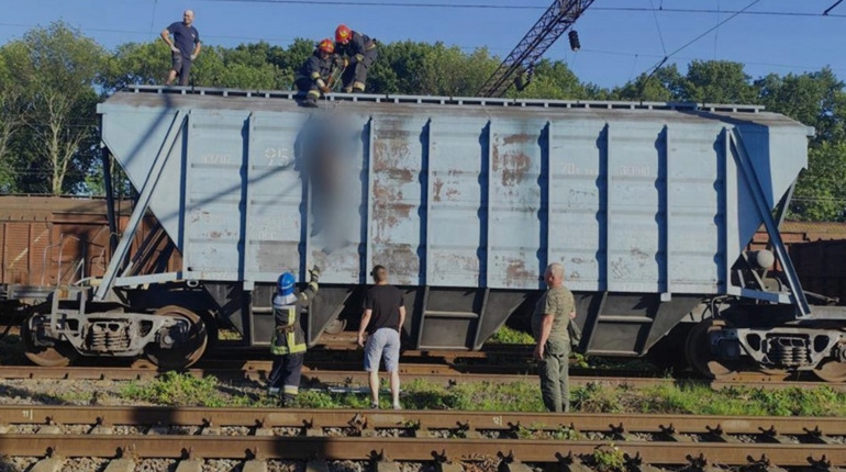 Як почуває себе дівчина з Ніжина, яка зазнала ураження електрострумом на даху потяга?