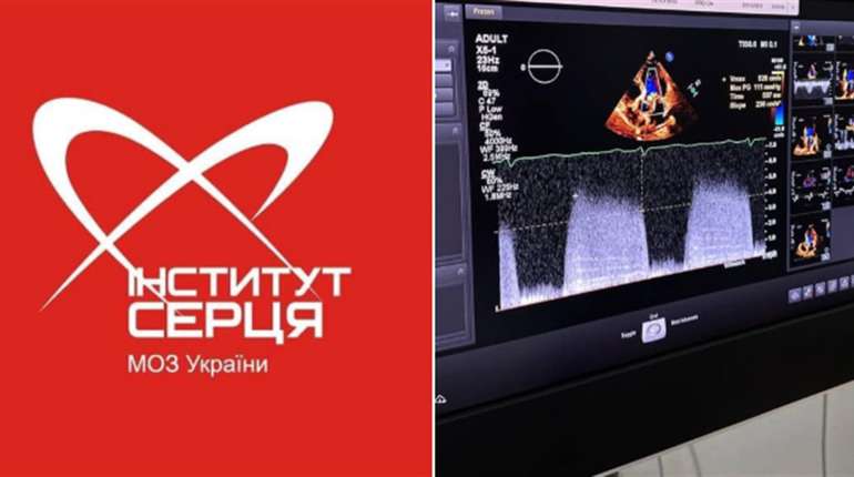 У Ніжині працюватимуть фахівці інституту серця. Зверніть увагу!