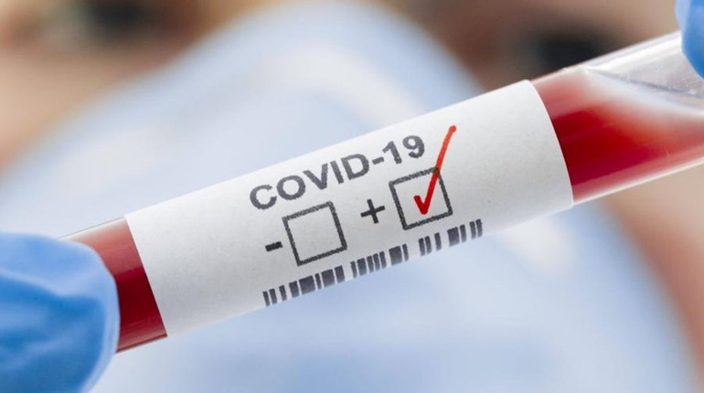 На Полтавщині внаслідок COVID-19 померли двоє людей