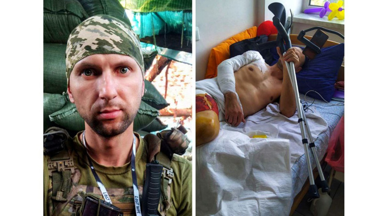 Від передової на Донеччині до лікарняних палат: історія Захисника з Фастова Олександра Редька