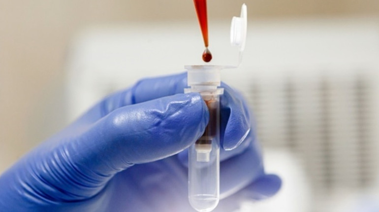 В Україні спалах вірусу Коксакі: все, що потрібно знати про небезпечну лихоманку