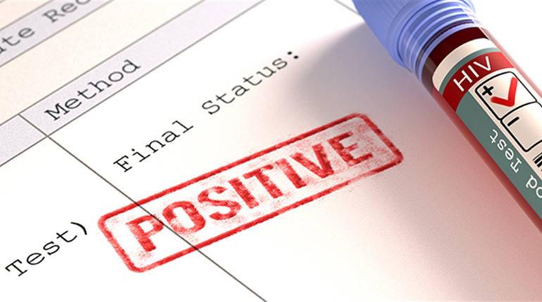 На Полтавщині зростає кількість людей з ВІЛ: що важливо знати