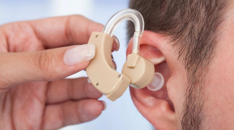 Як отримати слуховий апарат безкоштовно: в Україну надійшли майже 7 тисяч пристроїв